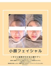 ソワナ(soina)/【神楽坂駅/フェイシャル/毛穴】