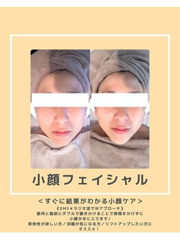 ソワナ(soina)/【神楽坂駅/フェイシャル/毛穴】