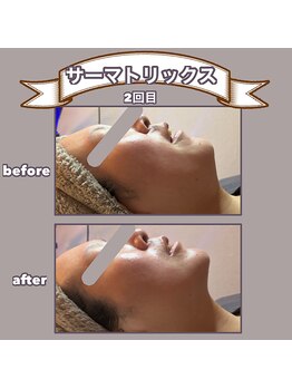 ビーマジック(美magic)/