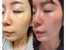 フェイスプラスリフ(FACE+RiF)の雰囲気(お客様全員ノーファンデの実績◎)