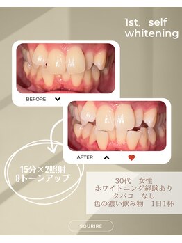 スリール(sourire)/