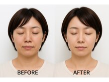 ビテ(Bite)の雰囲気（専用の美容液を使用◎毛穴洗浄でツルツルな透明のお肌へ）