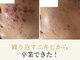 ルナティアラ(LUNAティアラ)の写真