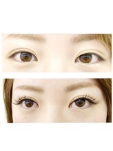 レセ(L’ce)/【ビフォーアフター】140本　　