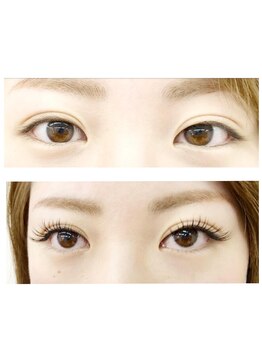 レセ(L’ce)/【ビフォーアフター】140本　　