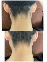 エン(en.)/BeforeAfter写真32