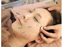 リリーフ(relief)