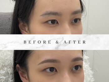 ナキ 富山店(Naki)/眉毛施術例 (眉毛Before.After)