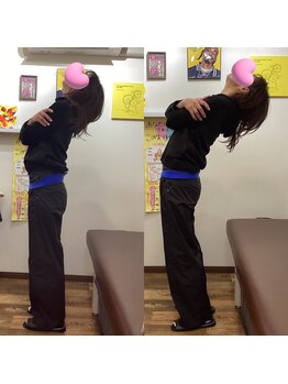 ヒデ整体院(Hide整体院)/猫背矯正骨盤矯正B/A肩こり腰痛