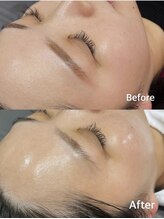 ティアラ(tiara)/劇的艶肌！韓国美容ララピール