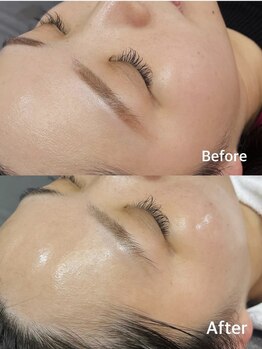 ティアラ(tiara)/劇的艶肌！韓国美容ララピール