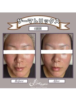 ビーマジック(美magic)/