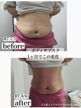 ゴールデンエイジ(Golden Age)/サブスク利用で1ヶ月の変化★