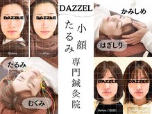 ダズル(DAZZLE)