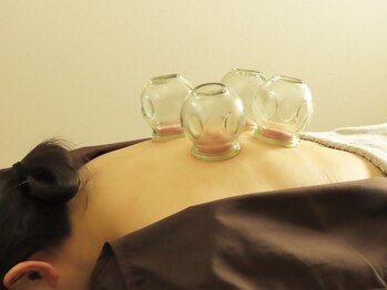 ライズ鍼灸院整骨院 所沢駅 秋津駅(RISE鍼灸院整骨院)/カッピング