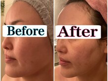 トータルビューティーサロン 凛/たるみのお悩み