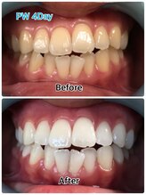 ドクターモック(Dr.MOC)/ＢＥＦＯＲＥ→ＡＦＴＥＲ