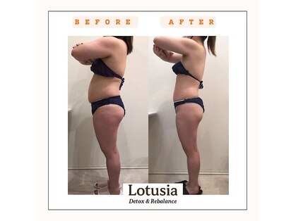 ルトゥーシア(Lotusia)の写真