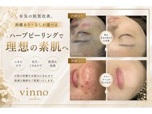 ヴィノ(VINNO)