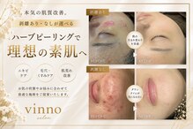 ヴィノ(VINNO)