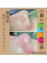 リンカ(Rinca)/毛穴綺麗！ゴワつき解消