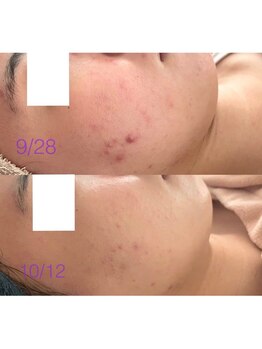 モーヴ 藤沢(MAUVE)/