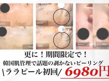 フルブルーム(Full Bloom)