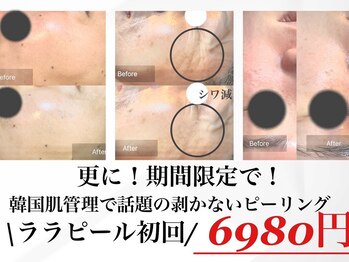 フルブルーム(Full Bloom)