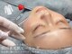 ラティーナ(Lattina)の写真/【美容医療提携/★韓国水光肌WiQo水光ピーリング★オーダーメイドパック付¥12800】韓国でも大人気最強ツヤ