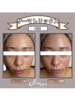 ビーマジック(美magic)/