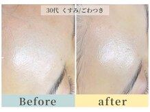 ムク(Muqu.)/潤艶Wax &シルキー糸脱毛