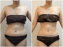 美容整体 ウェリナ 蟹江院/小顔矯正/骨盤矯正/美脚サロン 