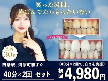 ホワイトニングショップ 四条店