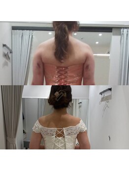 ディア スプリーマ/効果絶賛!!ブライダル11回