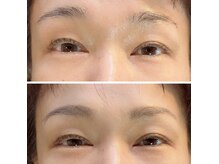 るりはなの雰囲気（キリっとした雰囲気にと。左右差を整えながらメイクでフォロー）