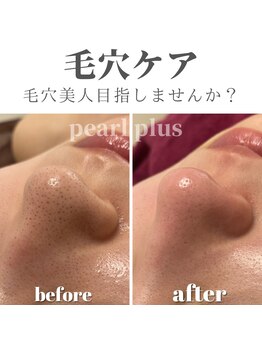 パールプラス 行橋店/毛穴ケア◎毛穴ごっそり洗浄