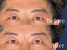 リジュベ(Rejuve)/メンズアイブロウ［まゆ毛］