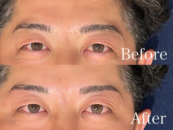 リジュベ(Rejuve)/メンズアイブロウ［まゆ毛］