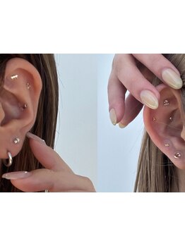 小顔になりたい