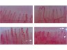 【健康診断に向けダイエット】血液からサラサラに♪カウンセリング＆体験施術