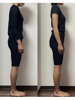 シック(chic)/全身】姿勢/骨格矯正/初回¥8,000