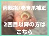 【巻き爪・陥入爪ケア】両親指/2回目以降の方はこちら♪