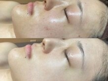 シャルトルズ 広島八丁堀店の雰囲気（ただの洗浄ではありません。細かく設計された洗浄工程）