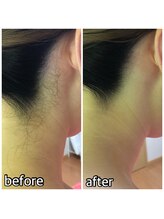 パーソナルエステティックサロン リボーン(ReBorn)/