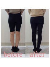 スタイルラボ高松/産後骨盤矯正の効果♪