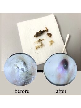 オスマンサス(Osmanthus)/before→after