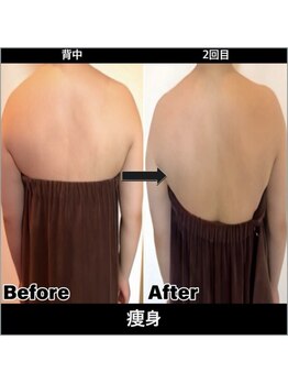 Sスタイルスタジオ 福岡天神/上半身そう身2回目のお客様