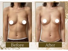 マリン(MARINE)/Before→After