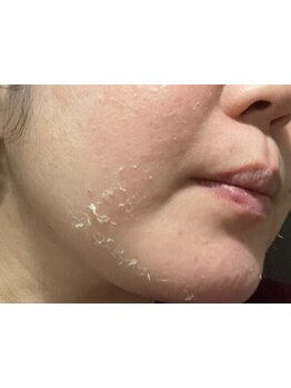 お肌をきれいにしたい