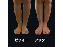 ヒヨリ(hiyori)/ゴットクリーナー